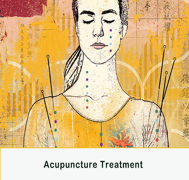 acupuncture-treatement