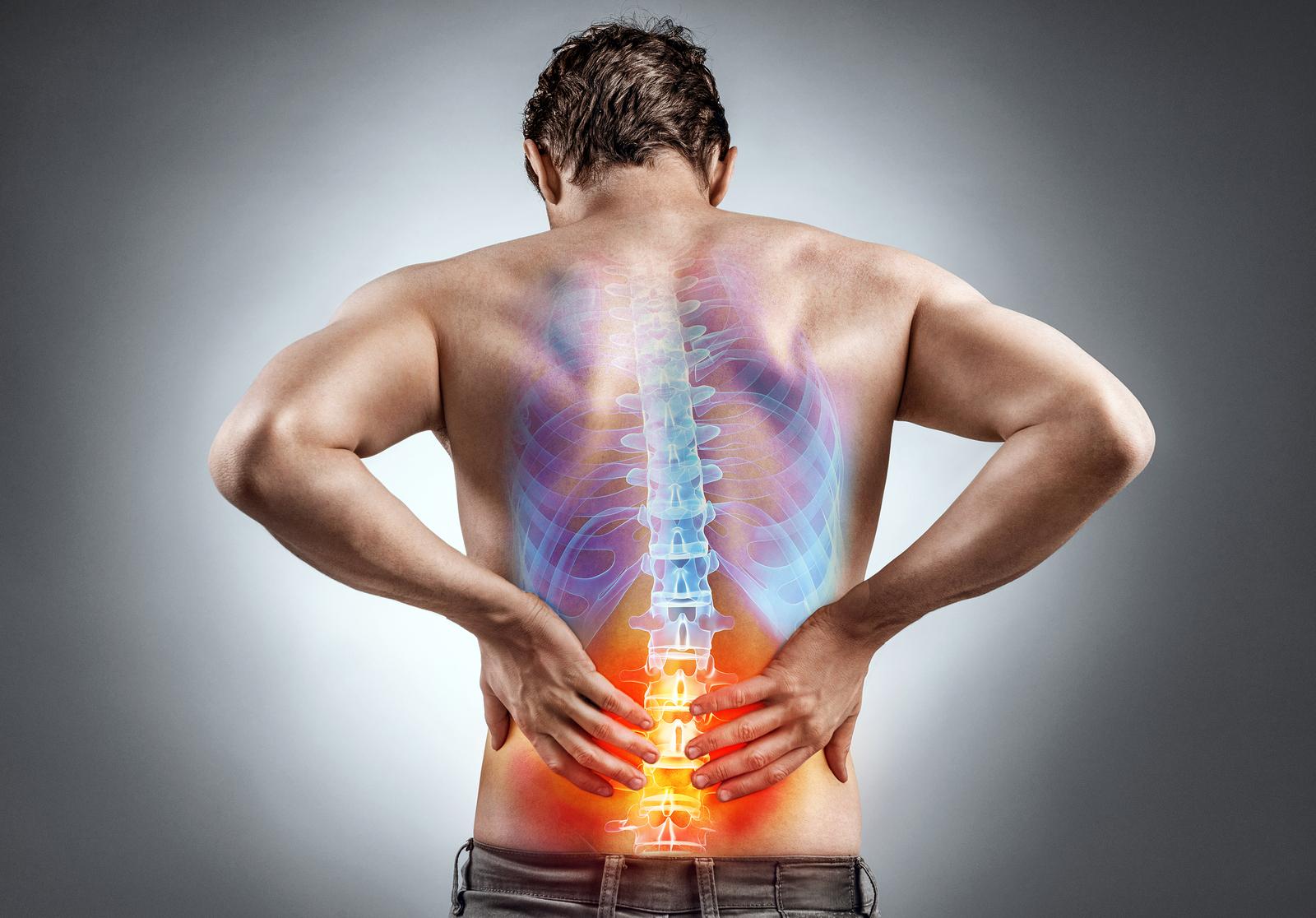 Back Pain: natural Remedies